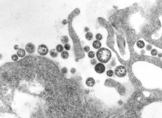 Liberia: 3 Lassa fever deaths reported in Nimba
