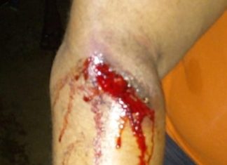 Woman falls victim to AFL’s brutality during lockdown in Monrovia