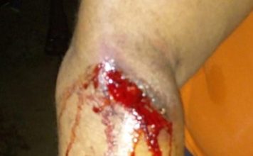 Woman falls victim to AFL’s brutality during lockdown in Monrovia