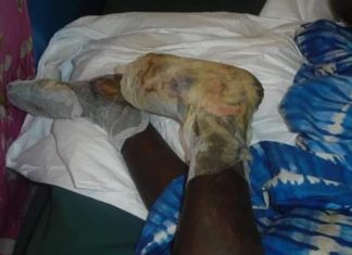 Imam sentenced to 2 years for severe burn on Nephew in Grand Cape Mount