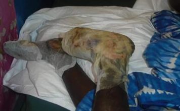 Imam sentenced to 2 years for severe burn on Nephew in Grand Cape Mount