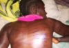 Woman, 50, Brutalized by Six Police Officers in Lofa