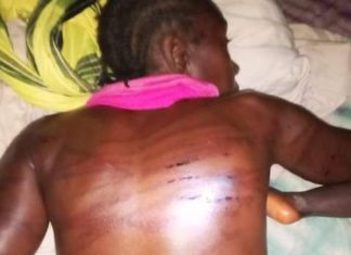 Woman, 50, Brutalized by Six Police Officers in Lofa
