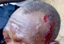 Voter trucking turns sour; 3 sustained severe wounds in election related clashes in Cape Mount