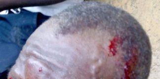 Voter trucking turns sour; 3 sustained severe wounds in election related  clashes in Cape Mount