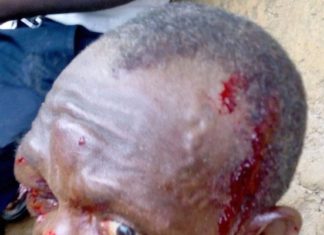 Voter trucking turns sour; 3 sustained severe wounds in election related clashes in Cape Mount