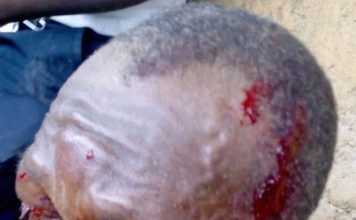 Voter trucking turns sour; 3 sustained severe wounds in election related clashes in Cape Mount