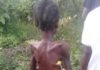 SOS call for 15-Year-Old girl ill-treated for alleged Witch in Nimba County