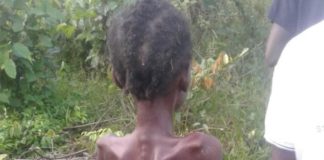 SOS call for 15-Year-Old girl ill-treated for alleged Witch in Nimba County