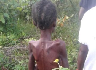 Liberia: Ailing 15-year-old girl accused of ‘witchcraft’ finally dies in Nimba