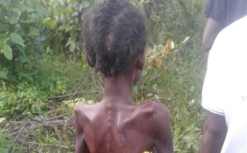 Liberia: Ailing 15-year-old girl accused of ‘witchcraft’ finally dies in Nimba