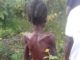 SOS call for 15-Year-Old girl ill-treated for alleged Witch in Nimba County