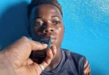 Boy, 16, arrested for chopping-off friend’s hand