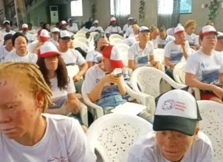 Albinos Society blasts govt of neglection…plea to meet Pres. Weah on their plights