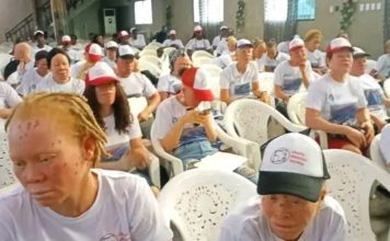 Albinos Society blasts govt of neglection…plea to meet Pres. Weah on their plights