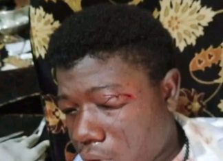 Opposition party condemns Independence Day brutality against protesting student group students brutalized