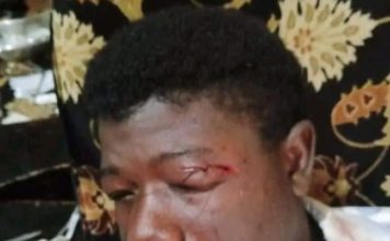 Opposition party condemns Independence Day brutality against protesting student group students brutalized